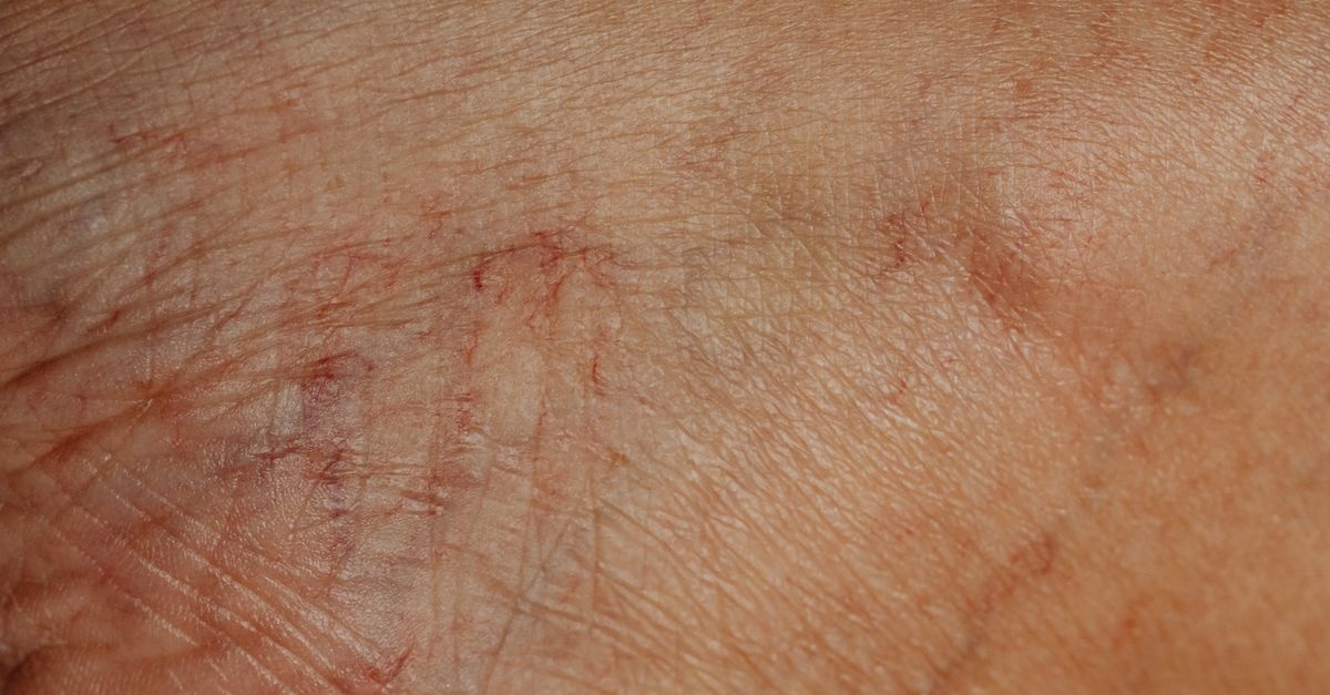 Glowy Skin trotz Trockenheit: Der Slugging-Trick für samtweiche Haut über Nacht