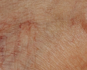 Glowy Skin trotz Trockenheit: Der Slugging-Trick für samtweiche Haut über Nacht